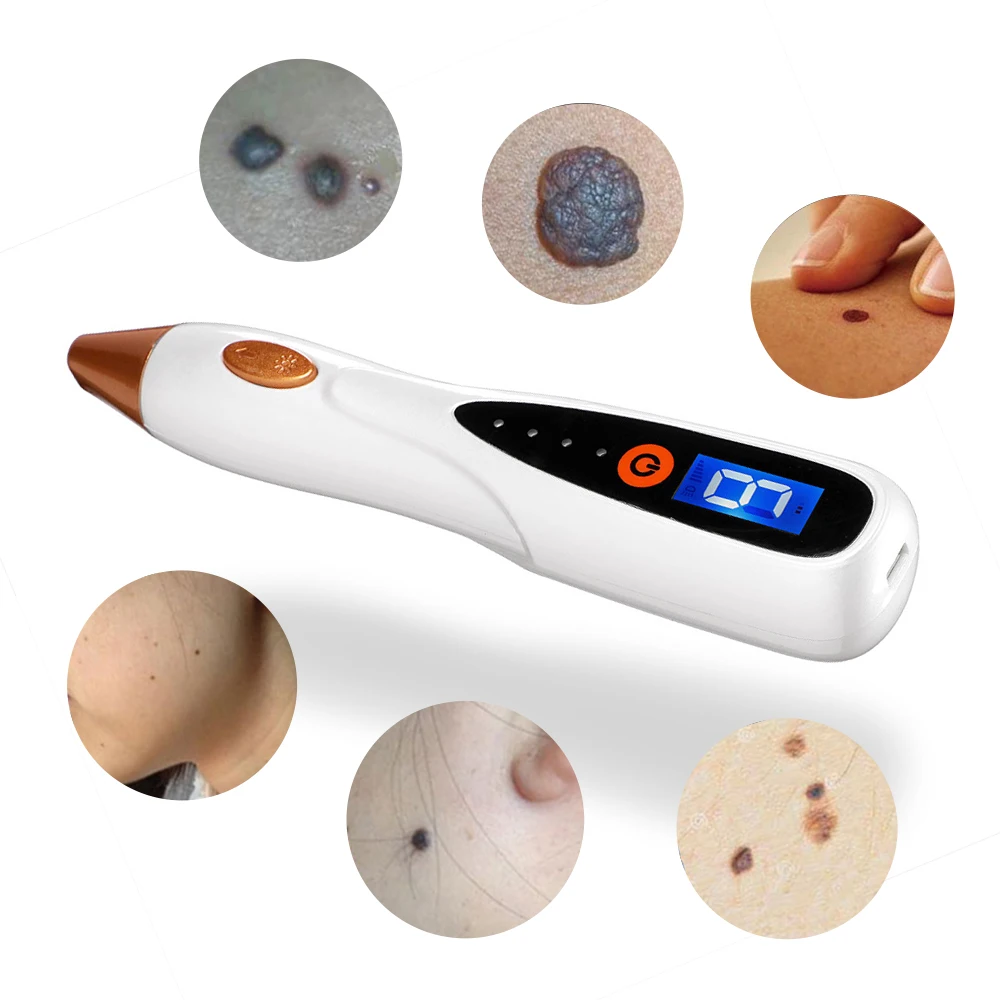 Веснушки для удаления точки моль лазерный указатель плазмы пятновыводитель