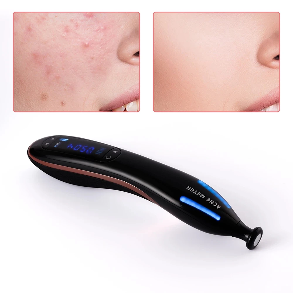 

5 Levels Blue Light Plasma Pen Scar Acne Removal Machine Skin Lifting Shrink Pores Ozone Therapy Acne Pen Facial Skin Care Tool