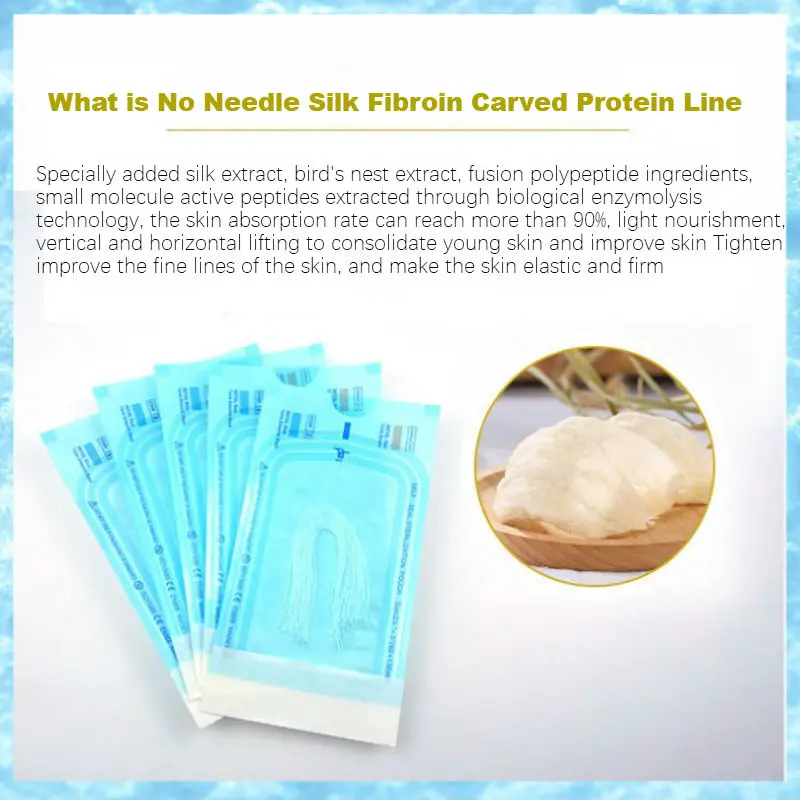 Рисунок 5 - 400 мешков, радарная нить