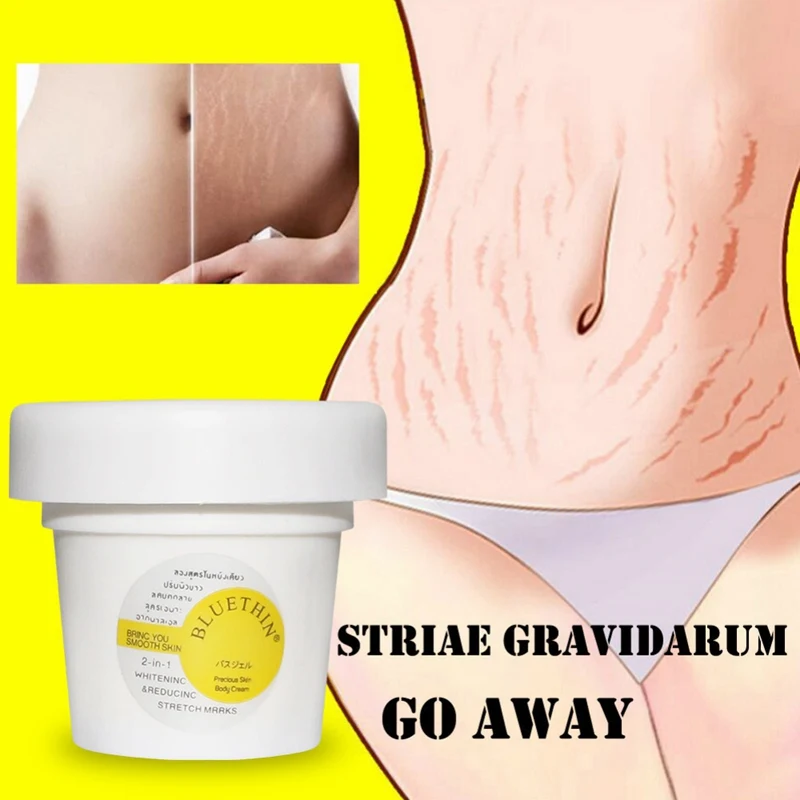Новое поступление эффективный крем для Удаления растяжек и шрамов подтягивающий