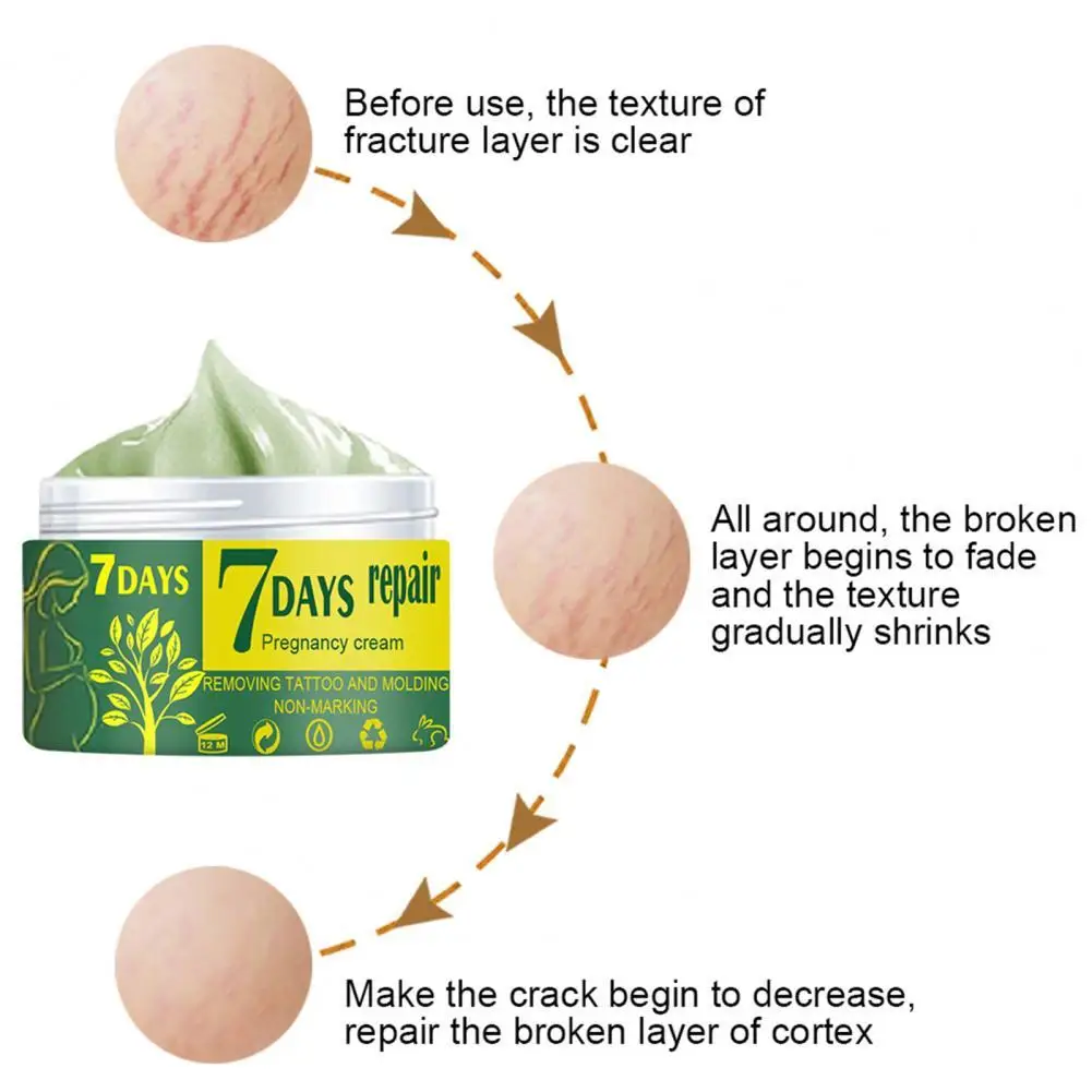 

Stretch Removal Natural Extracts Easy to Absorb Scar Remove Cream Pregnancy Repair Cream for Mother Skin for Mother
