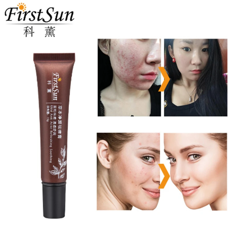 Firstsun травяной крем против акне для лица пятен от угрей шрамов лечение удаления