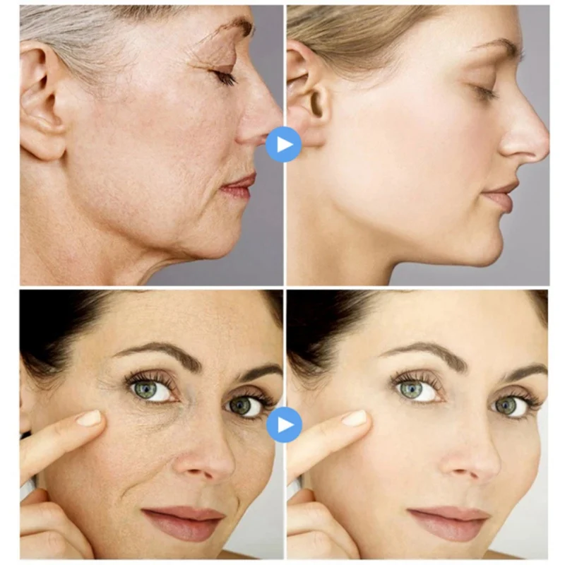 Гиалуроновая Кислота Витамин С Сыворотка витамина для лица C увлажняющая