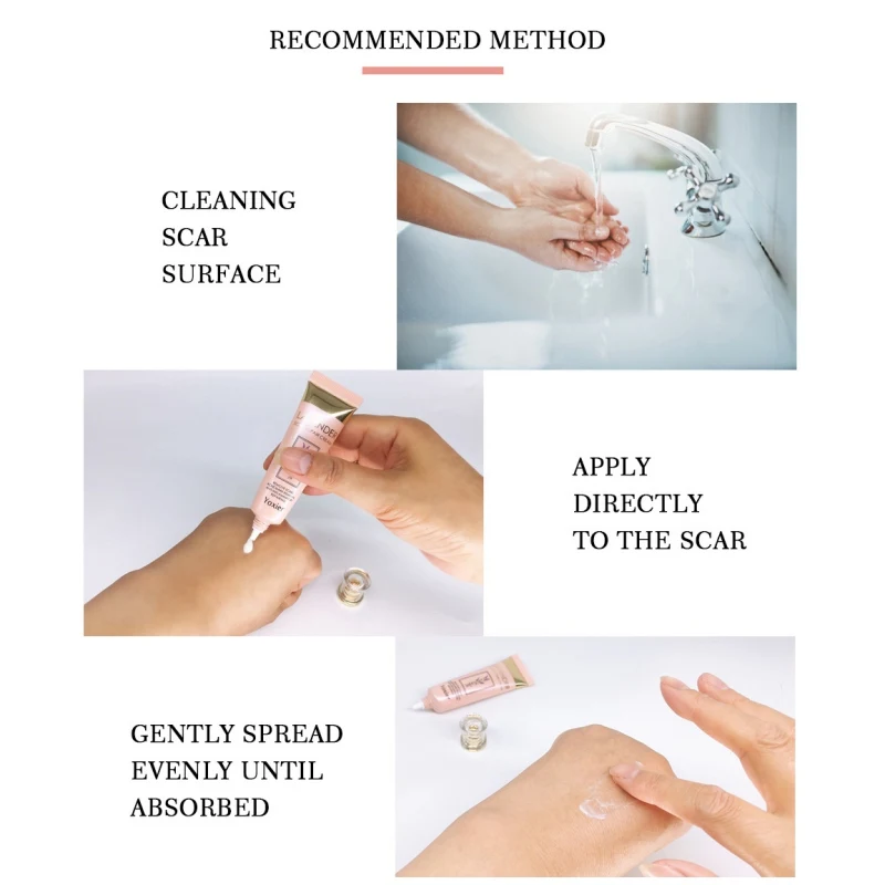 Крем Для Удаления растяжек после акне уход за кожей восстанавливающий крем для