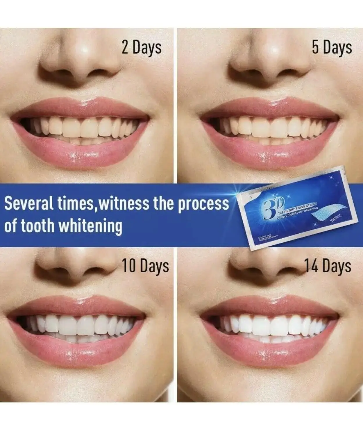 

3D Professional Advanced Teeth Whitening Strips 14 / 7 bags Peroxide Free Ki