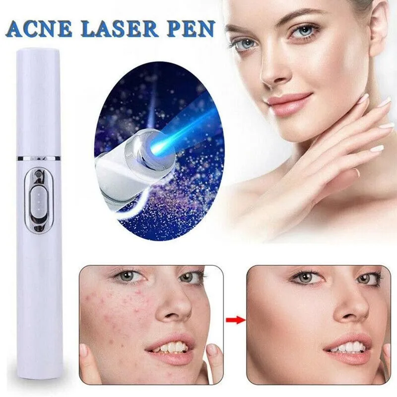 

Blue Light Therapy Acne Treatment Pen Soft Scar Care Tools Device Equipment Treatment Beauty Wrinkle Machine Removal Z3K0