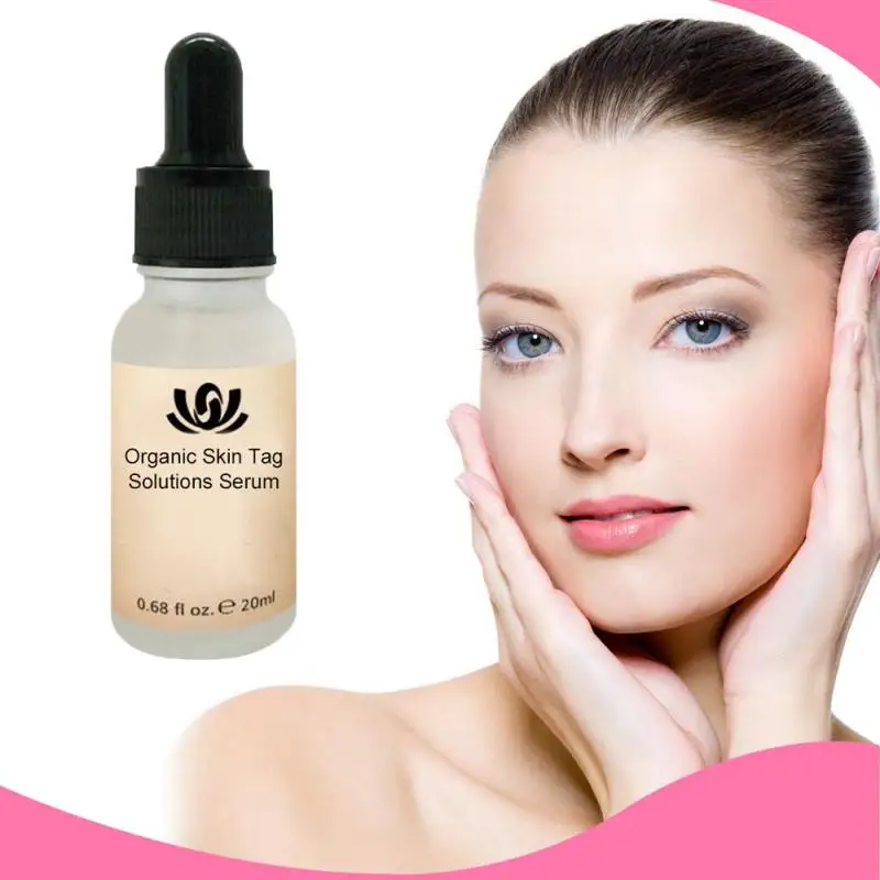 

Organic Tags Solutions Serum 20ML No Trace Painle Skin Tag Remover Serum Mole Removal Cream Painless Face Wart Mole Freckle