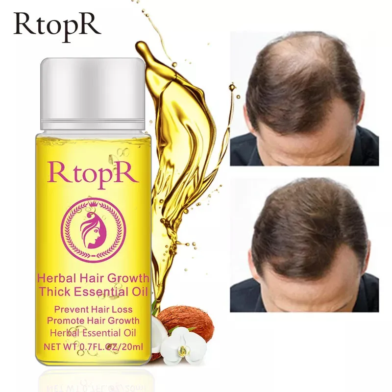 

Herbal Hair Growth Anti Hair Loss Liquid Promote Thick Fast Hair Growth Treatment Essential Oil Health Care Beauty Essence 20ml