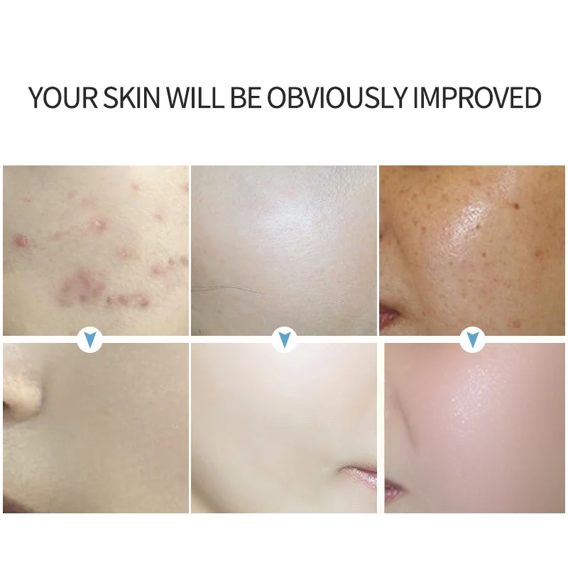 

YOUNGBOOK Whitening Essence 30ml Nicotinamide Hydrating Moisturizing Face Serum Fade Stains Brighten Skin Facial Serum