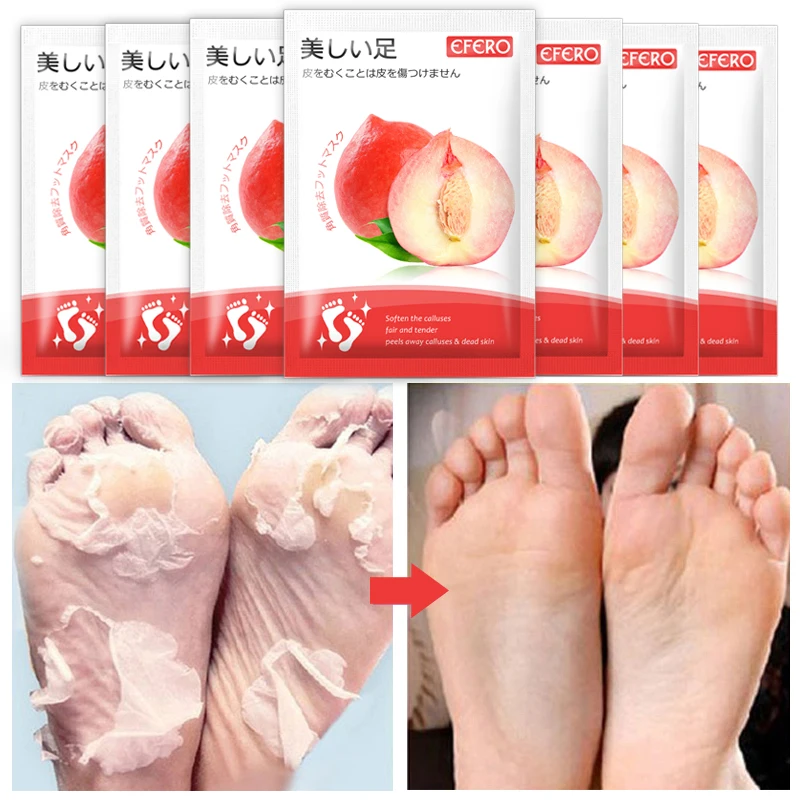 

4packs Peeling Foot Mask for Legs Remove Dead Skin Smooth Exfoliating Feet Mask +2Packs Whitening Nourish Hand Mask Spa Gloves