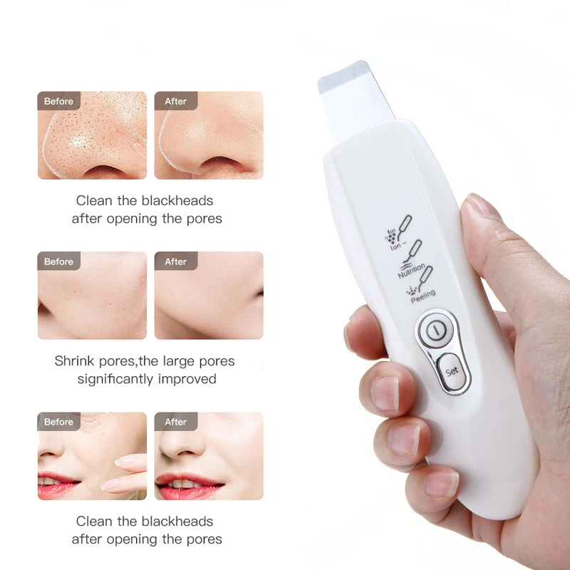 Ultrasonic Skin Scrubber Facial Deep Cleansing Pore Peeling Blackhead Removal Dead Extractor Face Cleanser |
