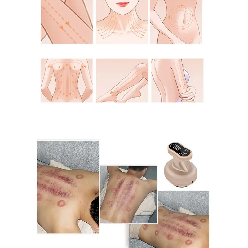 Электрический очищающий массажер 9 режимов Меридиан дренаж лимфатический дренаж Вакуумный Куб усталость болеутоляющее тело похудение домашний Горячий
