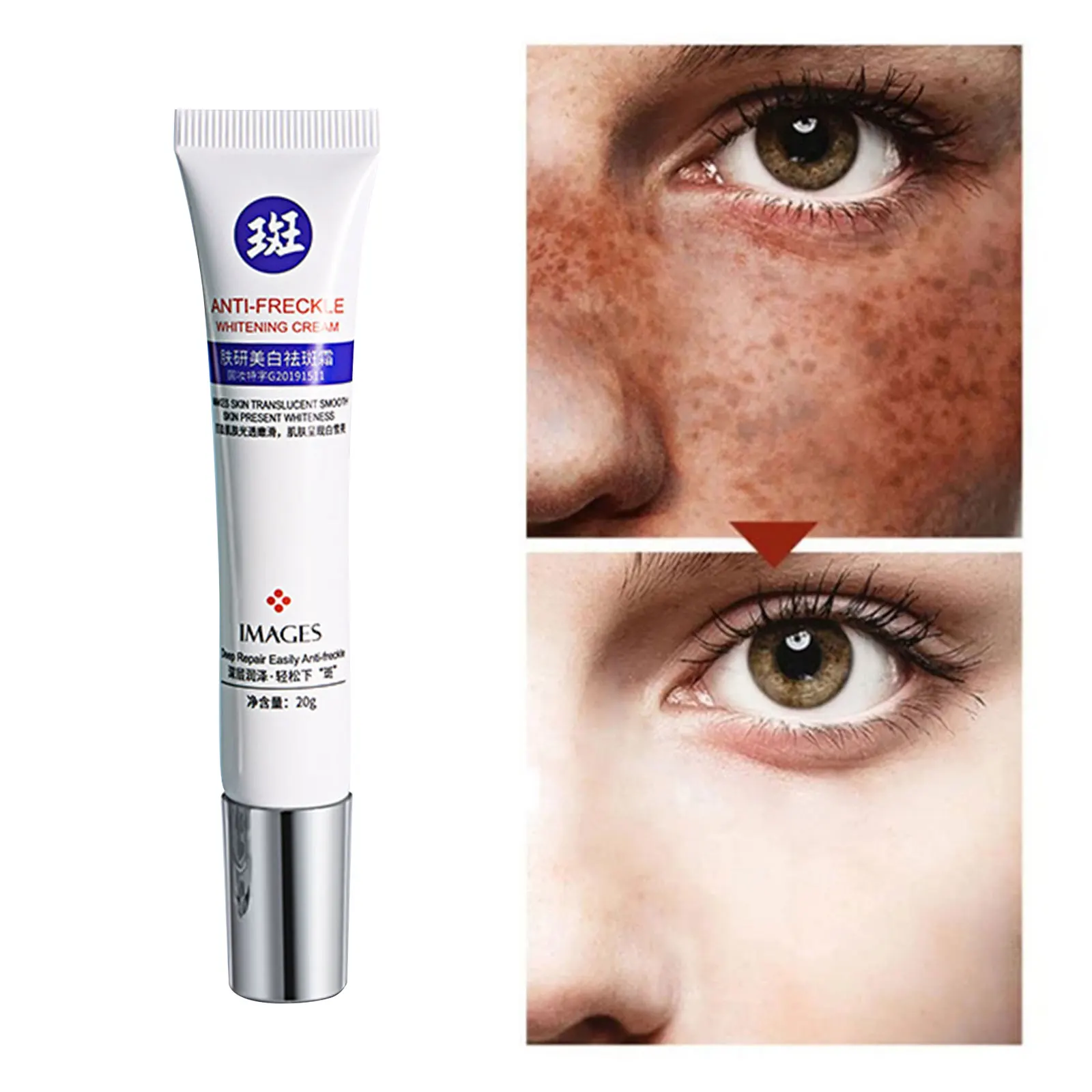 

Blemish Cream Pure Skin Anti Acne Scar Cream Freckles Acne Pimple Scar Dark Spots Removal Skin Whitening