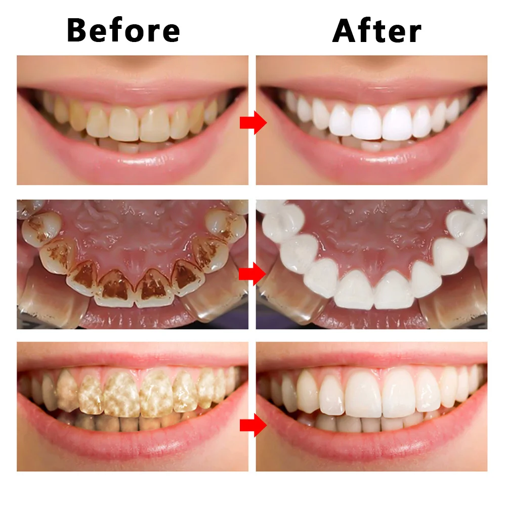 

10ml Teeth Whitening Essence With Swabs Teeth Essence Oral Cleansing Oral Hygiene Serum Remove Plaque Stains Tooth Oral Cleanser