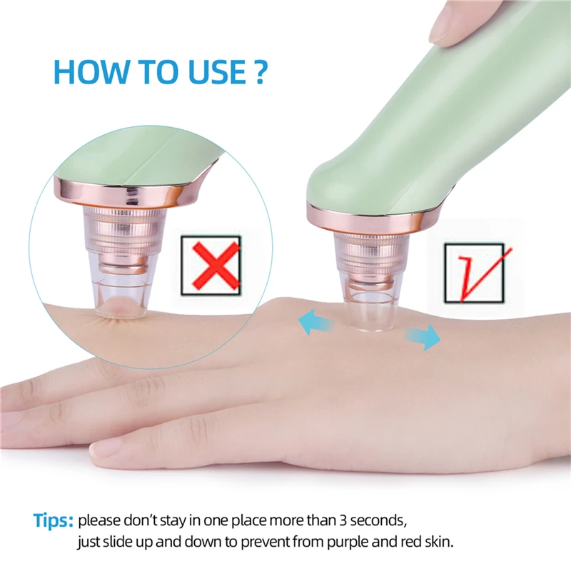 CkeyiN электрический пылесос для удаления черных точек лица очищающее средство пор