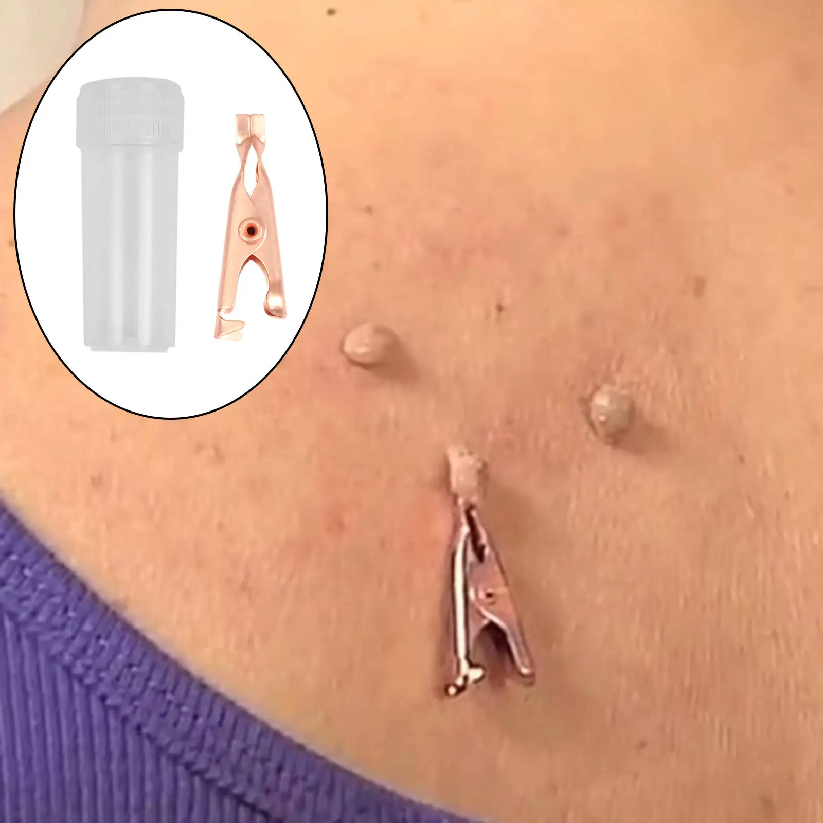 

Skin Tags Remover, Wart Tattoo Clip Skin Blemish Removers Copper Tags Out Beauty Makeup Tools