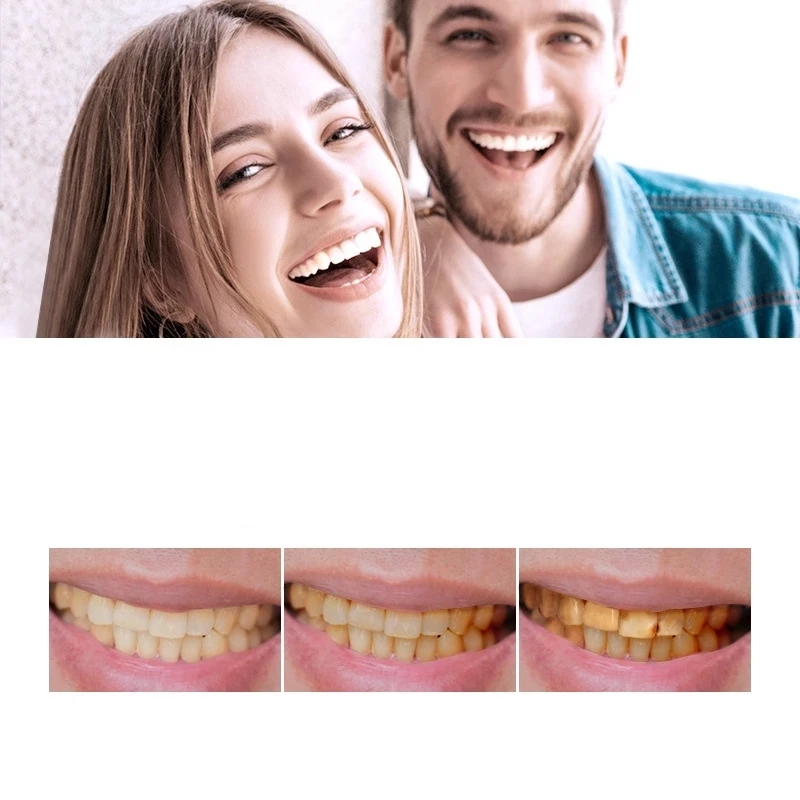 

Teeth Whitening Powder Teeth Cleaning Pearl Essence Tooth Care Dental Natural Toothbrush Tools Toothpaste Oral Hygiene