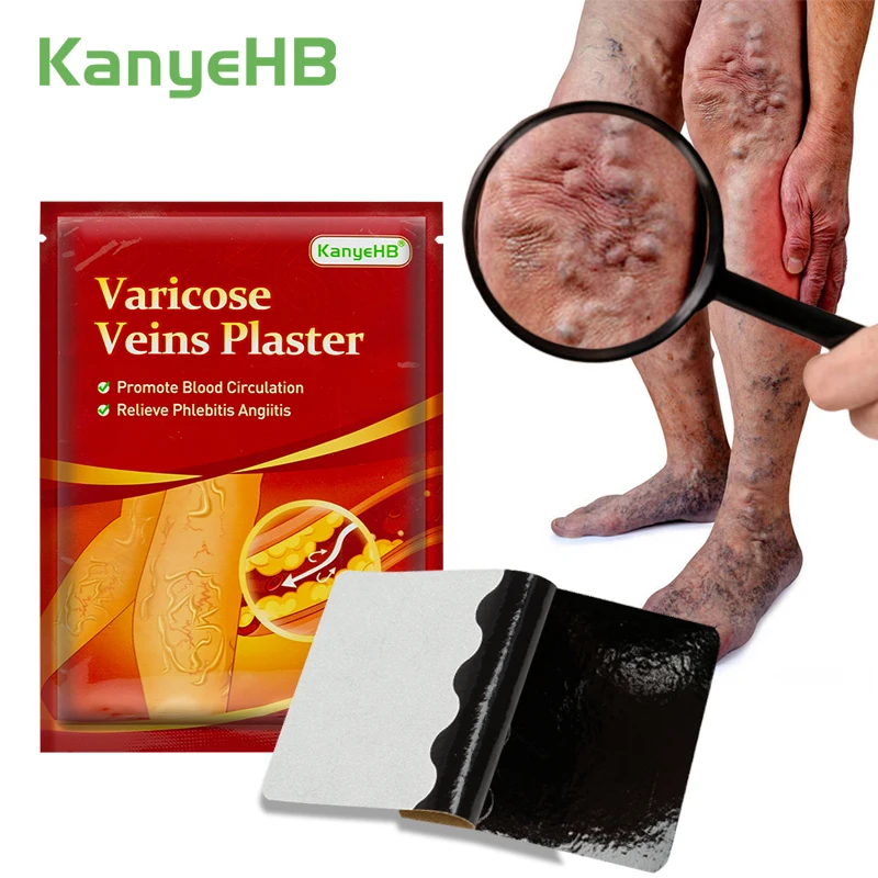 

6pcs/bag Varicose Veins Powerful Plaster Leg Vasculitis Phlebitis Patch Varicosity Angiitis Treatment Herbal Medical Patch W006