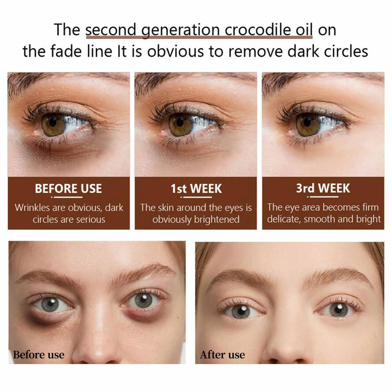 The Second Generation Eye Serum Reduces Dark Circles And Melanin 30ml | Красота и здоровье