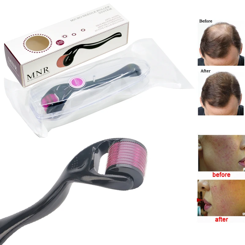 Microneedle Mezoroller Skin Meso DRS 540 Derma Roller Micro Needle for Hair Regrowth Face Care Anti-aging Wrinkle Removal Dermal