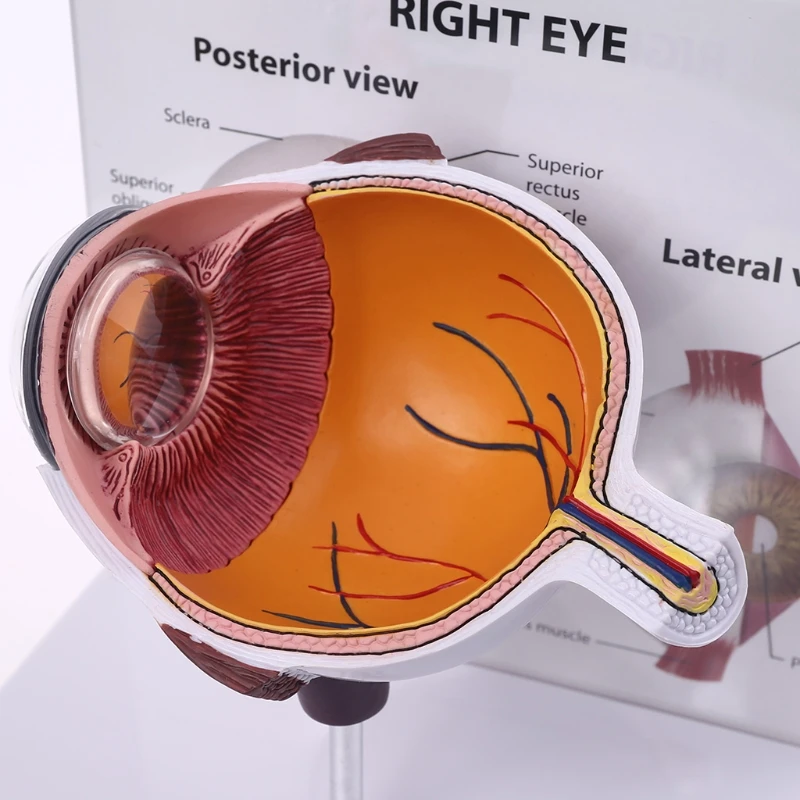 

Human Right Cross-Section Eye Eyeball Model Cross Section Anatomical Glaucoma Display Instrument Teaching Tool Anatomical Study