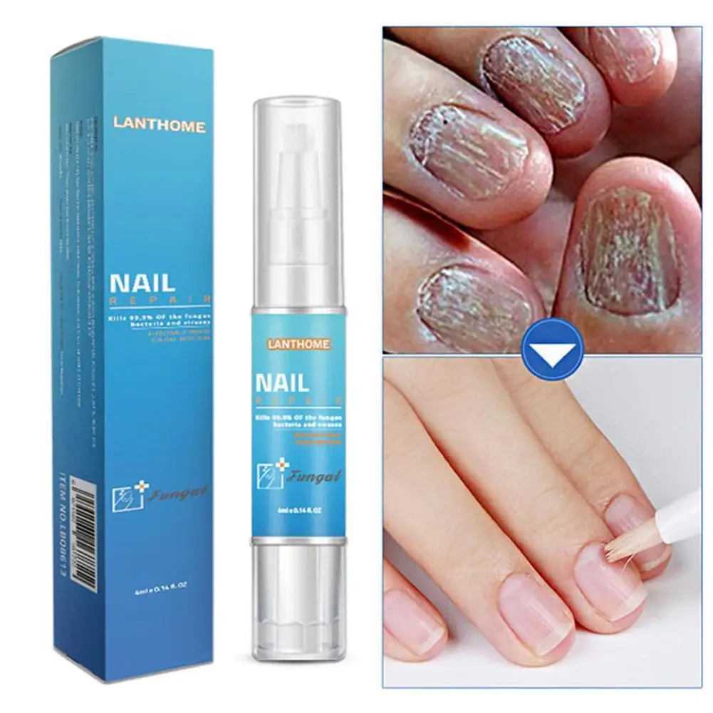 

4ml Fungal Nail Treatment Pen Nail Fungal Treatment Nutritious Oil Anti Restores Toenails Fungus Infection Repair Solution