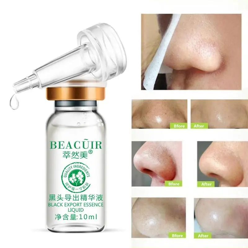 Удалить черная глубоко очищающая Очищающая уход за кожей лица Сыворотки для
