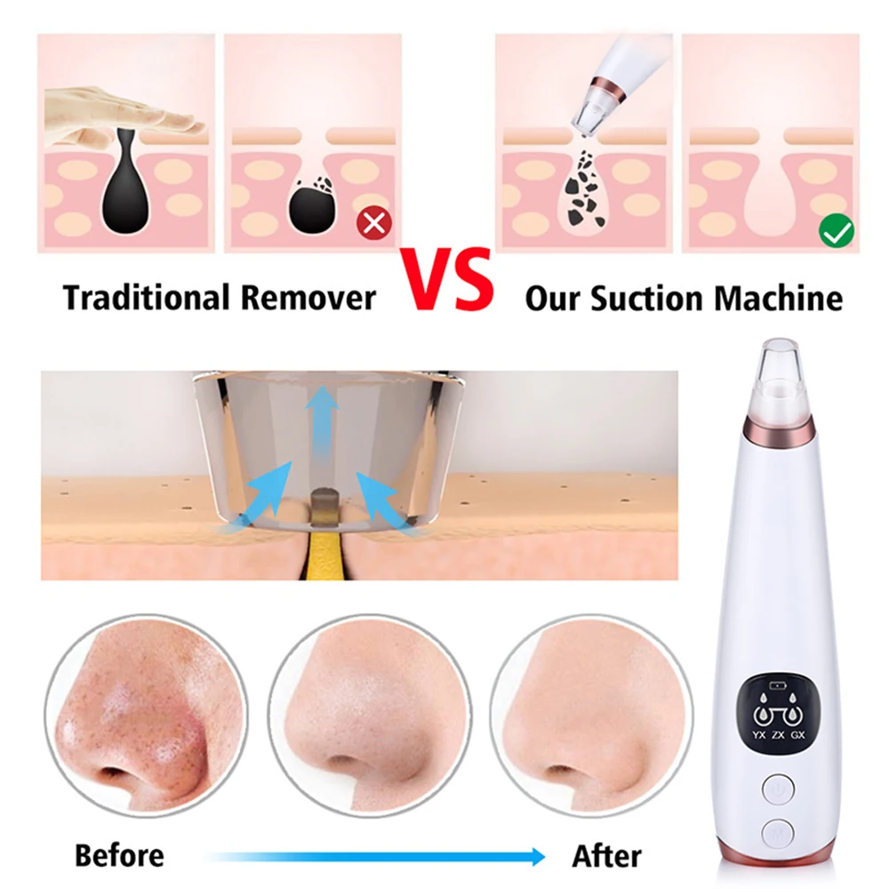 USB Перезаряжаемый прибор для удаления черных точек лица ПОР вакуум уход за кожей