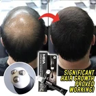 Роликовая Сыворотка для роста волос, массажер для кожи головы с тройным роликовым шариком, против выпадения волос, быстрое восстановление, лечение роста, эссенция