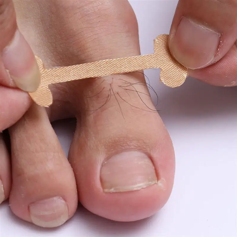 20 шт. стикеры на ногти инструмент для коррекции вросших пальцев лечения ногтей