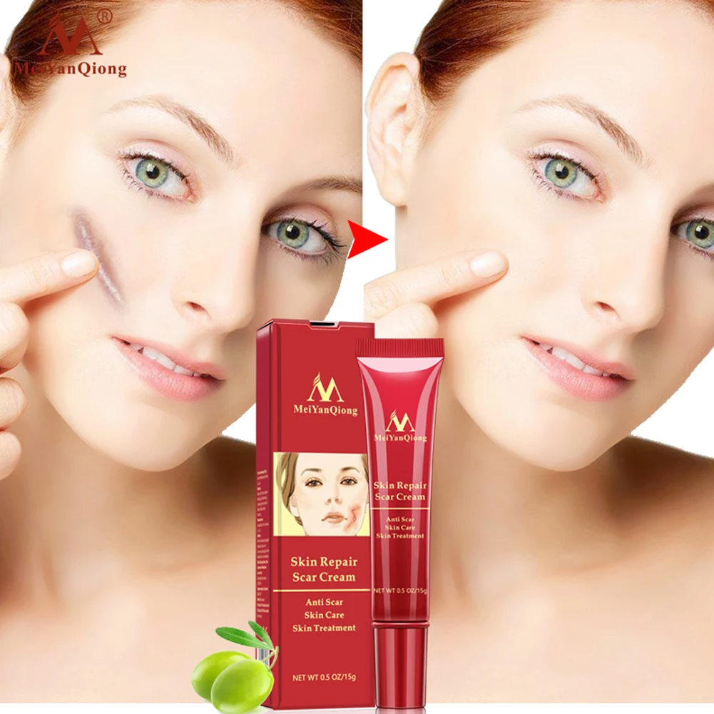 Мягкое удаление шрамов лечение кожи уход за кожей морщин гель для лица