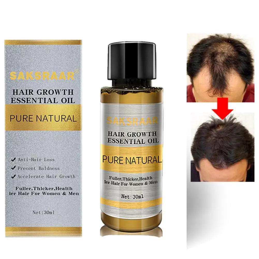 Уход за волосами для роста волос имбиря Эфирное Масла эссенция выпадения