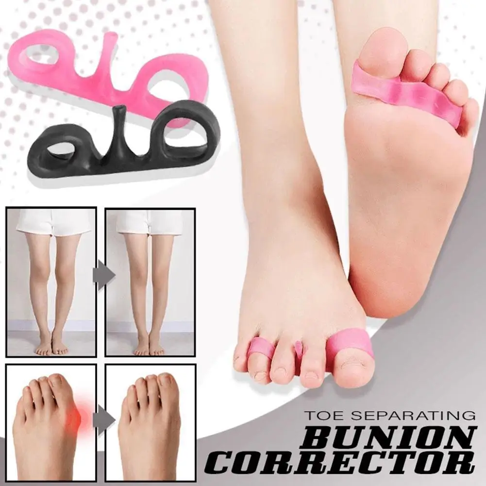 

Новый стиль, коррекция ноги, Φ, O-образное кольцо для ног, разделение разделения тонких ног, разделение кольца для ног