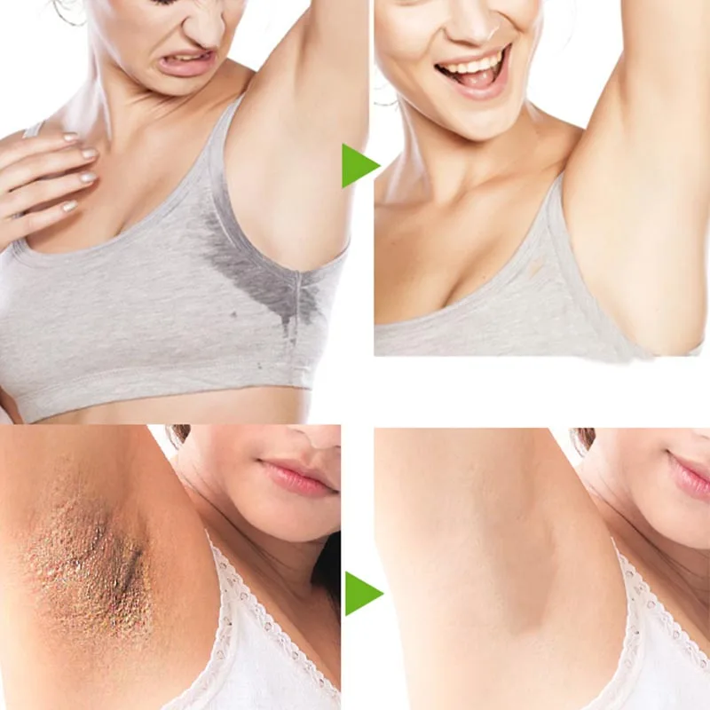 Дезодорант-антиперспирант для тела спрей удаления неприятного запаха подмышек