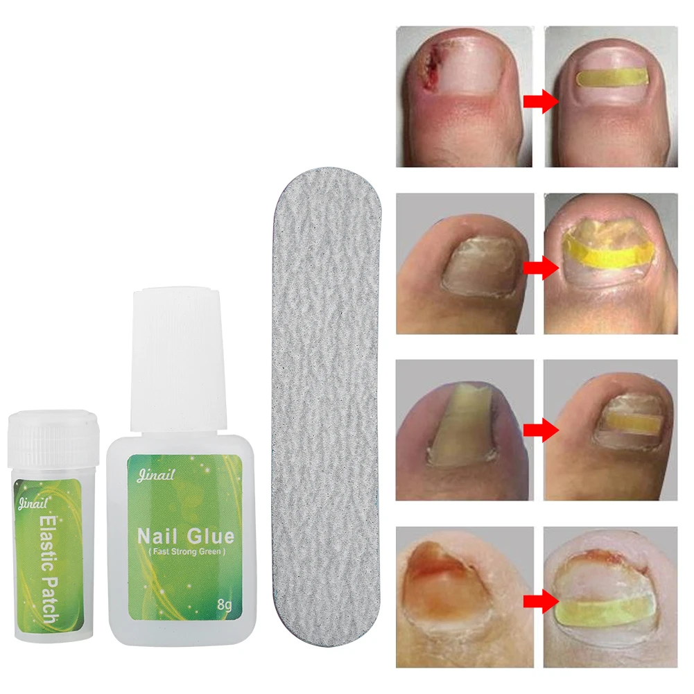 12/24 шт. эластичные патчи для маникюра и педикюра | Красота здоровье