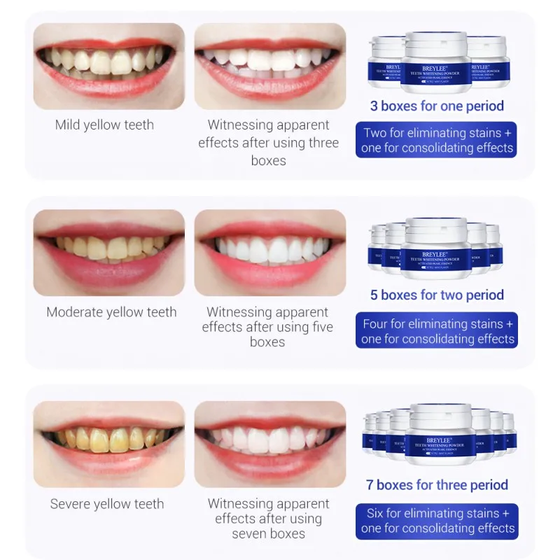 

Teeth Whitening Powder 30g Get Rid Of Tooth Yellow Stain Bad Breath Oral Hygiene Dental Tooth Care