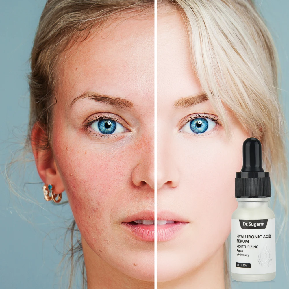 

Hyaluronic Acid Serum Moisturizing Essence Acne Treatment Face Serum Skin Care Repair Anti-Aging Shrink Pore Whitening Dry Skin