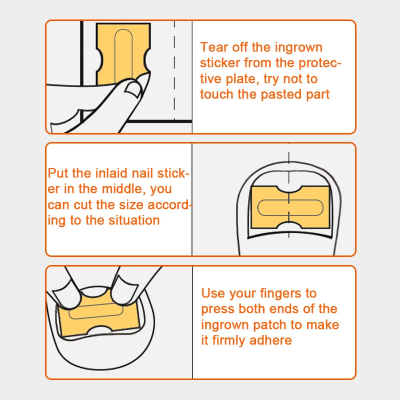 

Sumifun 10/30Pcs Ingrown Toenail Correction Patch Toenail Brace Pedicure Tool Double-sided Tape Foot Nail Correction Paste