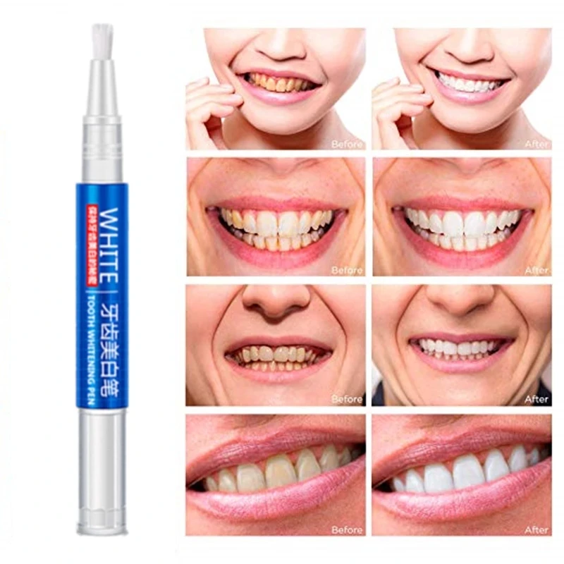 

New Whitening Oral Hygiene Pen Potent Teeth Whitening Gel Pen Natural Oral Care Remove Stains Tooth Cleaning Tool Whitener Teeth