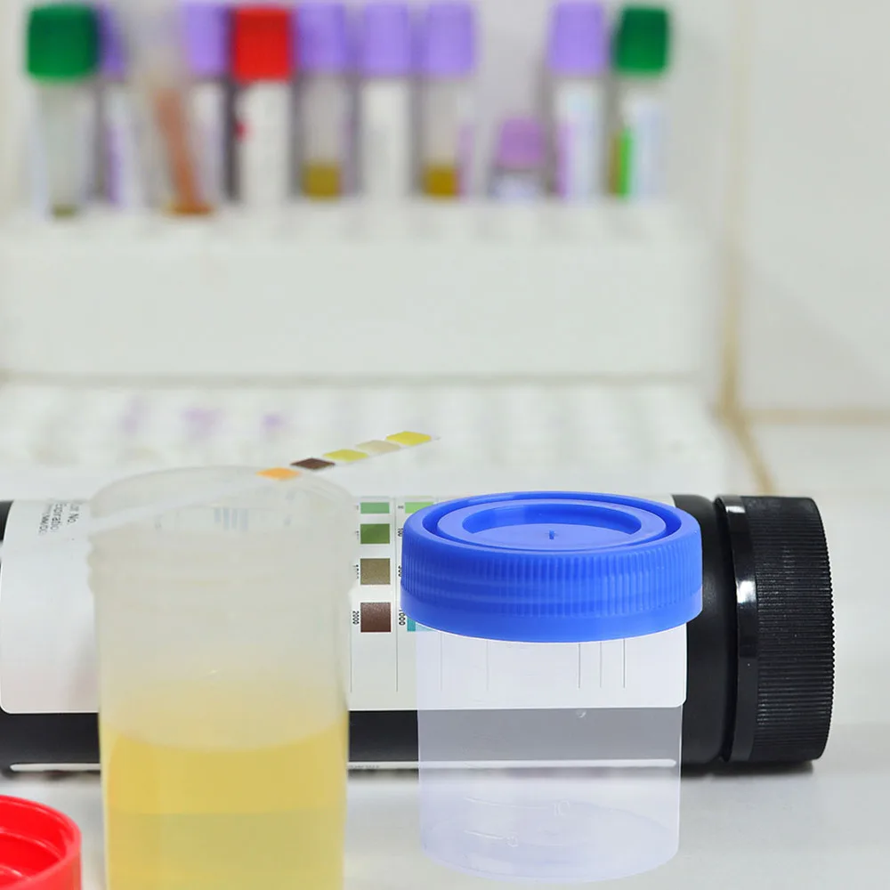 

10Pcs Urine Cups 120ml Fecal Cups Simple Urine Liquid Test Cups