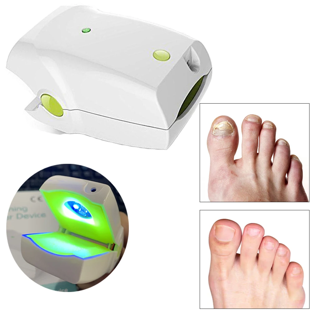 Rechargeable Nail Fungus Cleaning Treatment Device Handhold Toenail Onychomycosis Paronychia Removal Grey Nail Restore
