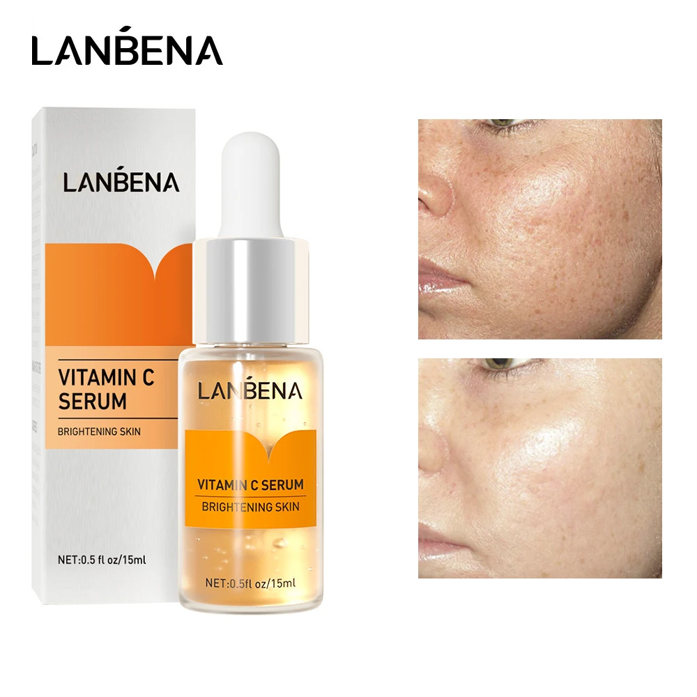 

LANBENA Vitamin C Whitening Face Serum Lighten Spots Brightening Facial Skin Essence Fade Dark Spots Remove Freckle Speckle Care