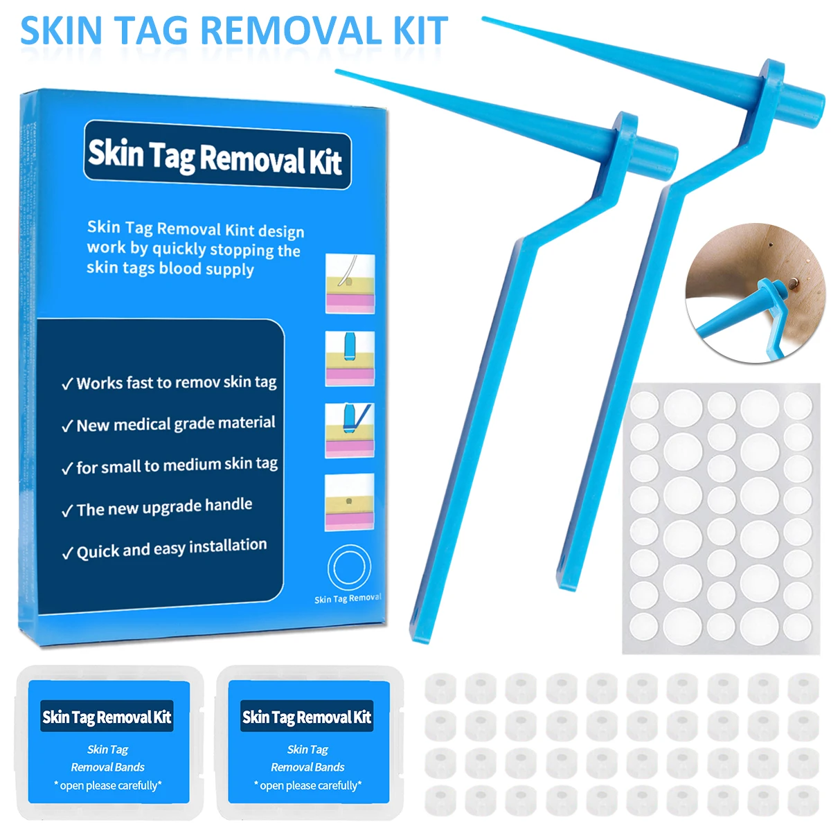 

Skin Tag Remover For Face Neck Fingers And Body Blue Safe And Painless Skin Tag Removal Kit For 2mm-8mm Mole Removal kit