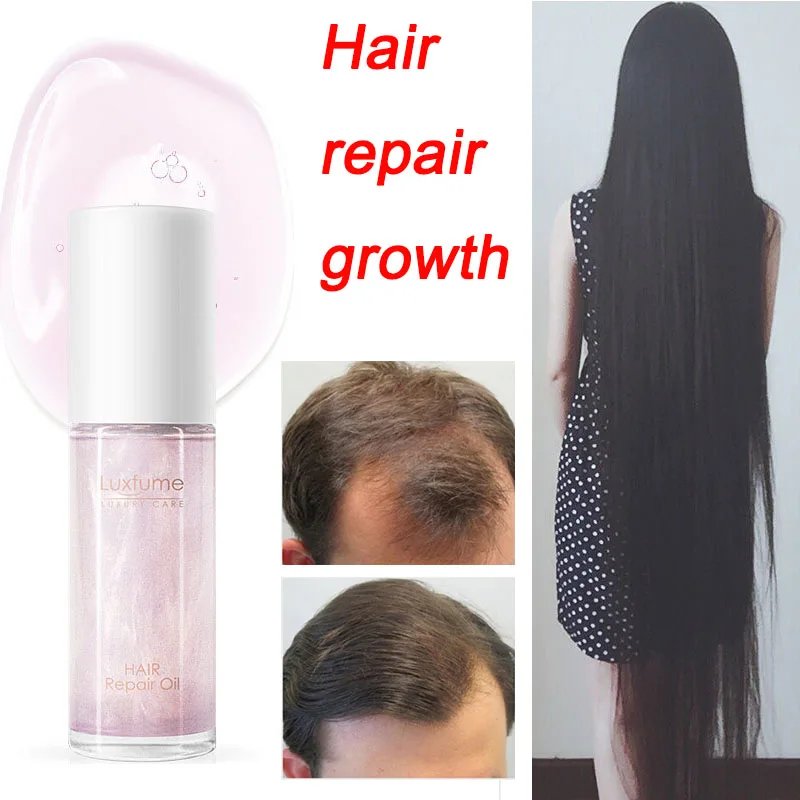 

Hair Care Growth Essential Oils Hair Loss Liquid Health Care Beauty Dense Growth Fragrant Flow Gold Naturel Plante Serum 30Ml