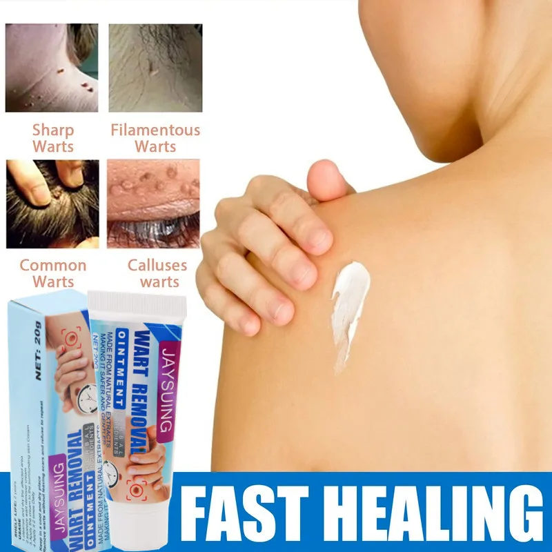 

Wart-removing Cream To Repair Ordinary Yuke's Body, Face and Neck Skin Whitening Skin Care Products Skin Whitening Products