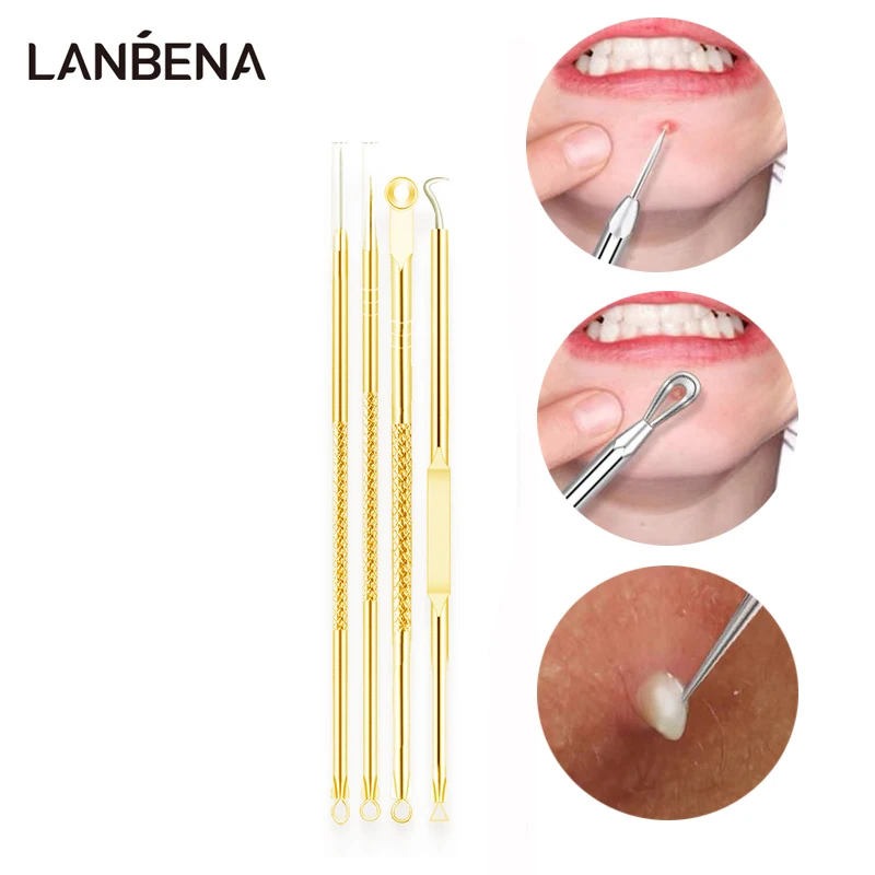 

LANBENA Acne Needle Acne Extractor Remover Tool Blackhead Blemish Remover Pimple Needle Double Head Needle High Quality 4pcs/Set