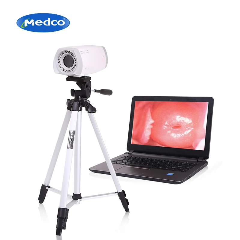 

Medical Portable Digital Colposcope for Gynecology