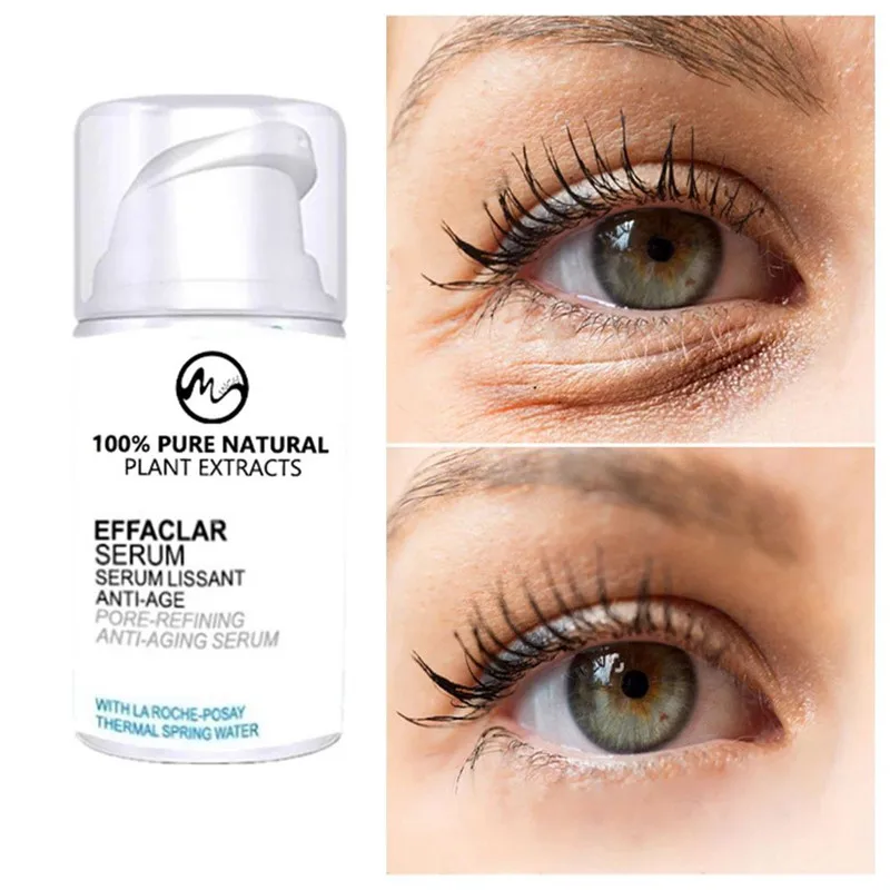 Minch мгновенный удалить против мешков под глазами крем для удаления кругов и гель