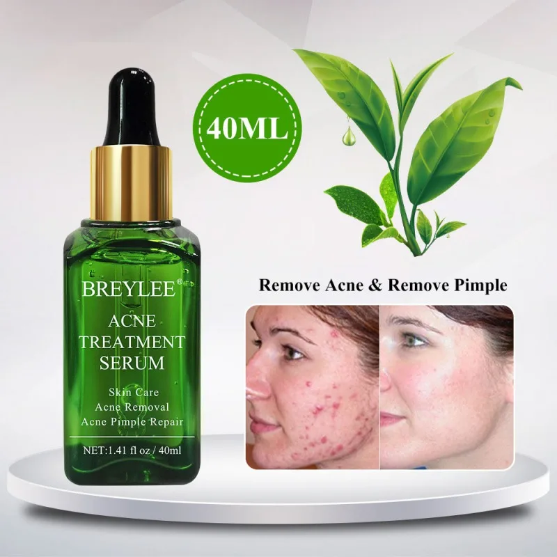 

Blackhead Removing Liquid Acne Treatment Set Face Serum Mask Pore Cleaning Shrink Liquid with 100Pcs Nose Mask