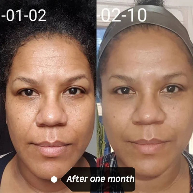 10% легкая сыворотка с пептидом антивозрастной уход за кожей лица 30 мл|Сыворотка| |